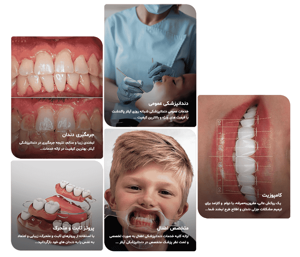 برخی از خدمات دندانپزشکی آیلار پاکدشت - دندانپزشکی در پاکدشت