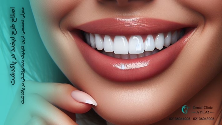 اصلاح طرح لبخند در پاکدشت - کلینیک دندانپزشکی آیلار - دندانپزشکی در پاکدشت