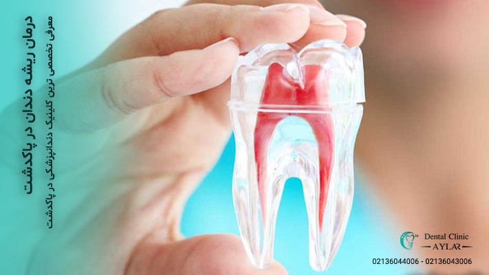 درمان ریشه دندان در پاکدشت - کلینیک دندانپزشکی آیلار - دندانپزشکی در پاکدشت